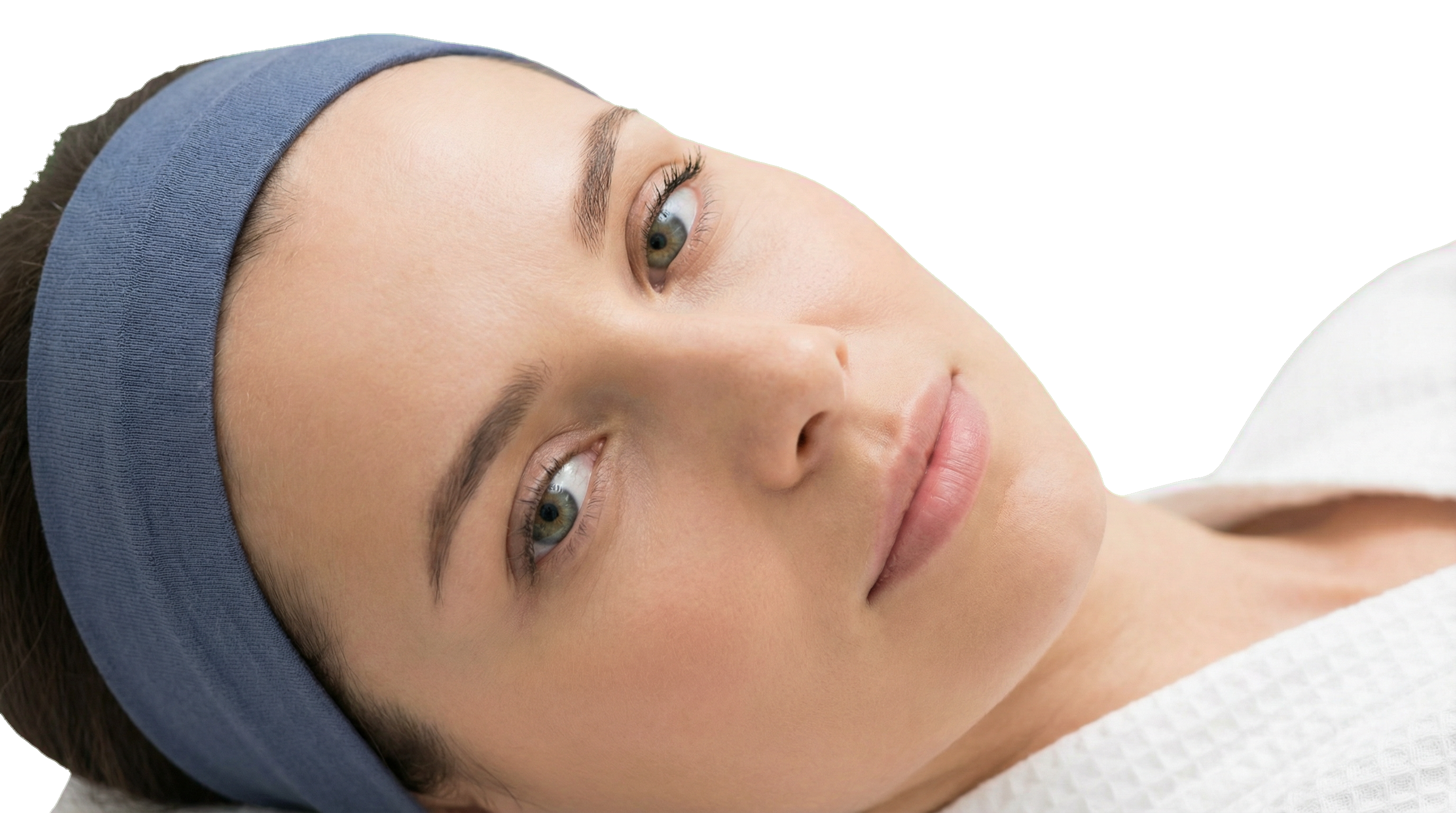 Lateral Browlift Result